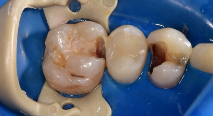 Before